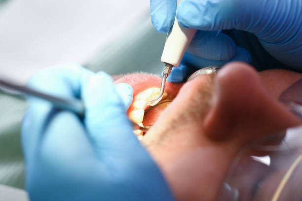 Best Emergency Treatment for Toothache in Fairfield, IA