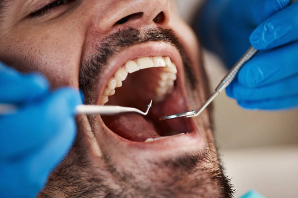 Best After-Hours Emergency Dentist in Fairfield, IA
