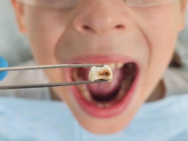 Best Emergency Dental Surgery in Fairfield, IA