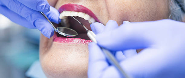Best Emergency Wisdom Teeth Removal in Fairfield, IA